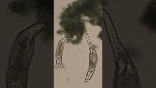 Rotifers Feeding [upl. by Krystle]