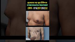 Best Gynecomastia treatment in Bangladesh  পুরুষের বড় স্তন চিকিৎসা [upl. by Jeralee752]