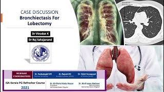 Bronchiectasis for lobectomy  Case Discussion  Kerala ISA PG Refresher Course 2021 [upl. by Dyanna688]