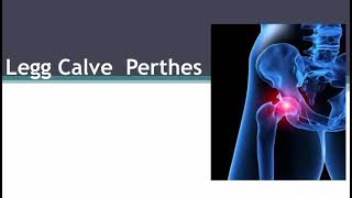 Calve Legg Perthes syndrome – what is it [upl. by Lehsreh788]