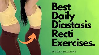 Heal amp Flatten With These Daily Diastasis Recti Exercises [upl. by Jo Ann125]