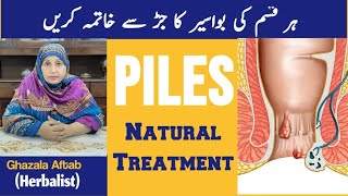 Bawaseer Ka Asan Gharelu ilaj  Piles Treatment In Urdu  Homemade Remedy [upl. by Meehyr]