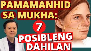 Pamamanhid ng Mukha 7 Posibleng Dahilan  By Doc Willie Ong Internist and Cardiologist [upl. by Sumaes]