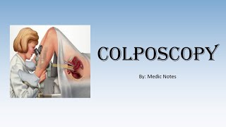 OampG Colposcopy  for medical students indications procedure abnormal results [upl. by Zsamot865]