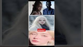 What is melanism and albinism medicine medicaldepartures drugeducation biology medicalstudent [upl. by Margaretha]