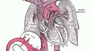 Why does Aortic Rupture cause so many deaths [upl. by Daren574]