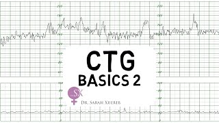 CTG Basics Part 2  Decelerations amp Fetal Physiology [upl. by Duky399]