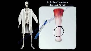 Achilles Tendon rupture Achilles tendon stress amp Strain Thompson test [upl. by Aititel]