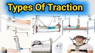 Types Of Traction  Traction Types  Orthopaedic Traction  skin and skeleton [upl. by Ahserb296]