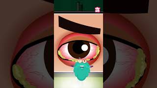 What Is Pink Eye What Causes Conjunctivitis shorts pinkeye conjunctivitis drbinocsshow [upl. by Sualkin]