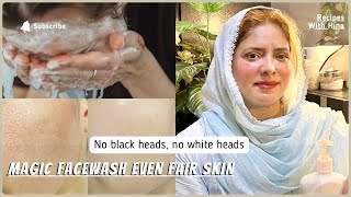 Fair Even Skin Tone  Black Heads Gone  Magic Face Wash  Instant Glowing Skin [upl. by Eldwin]