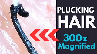 Plucking Hair Magnified 300x See Wet Limp Root Follicle Keratin Skin Cells [upl. by Yar]