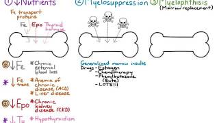 Erythroid Hypoplasia 2 [upl. by Caravette]