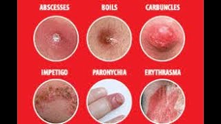 Skin Infections [upl. by Alexandria]