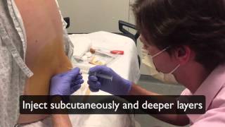 How to perform a lumbar puncture Lumbar puncture in the emergency department setting [upl. by Aylward]