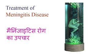 मैनिंजाइटिस रोग का इलाज  Treatment of Meningitis Disease Video 9 by Ayurveda amp Health [upl. by Decca]