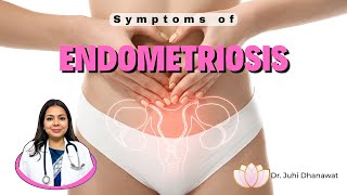 Symptoms of Endometriosis [upl. by Aicac706]