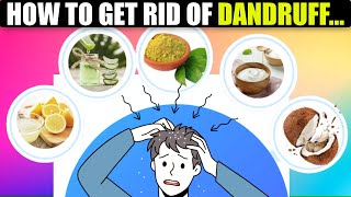 Dandruff Treatment at Home  How to get rid of Dandruff  Dandruff Removal  Amazing Tips [upl. by Gould72]