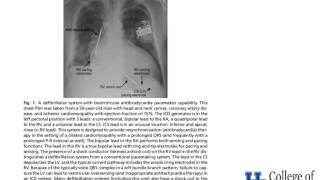 Basic Management of Perioperative Pacemakers  Dr Murphy [upl. by Elesig]