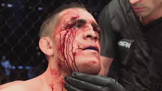 Nick Diaz as bloody as it can get UFC 5 [upl. by Eng622]