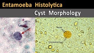 Entamoeba Histolytica Cyst Morphology [upl. by Dylana398]