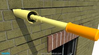 Structural Repairs  Brick Reinforcement with Helical Bars [upl. by Gnes]