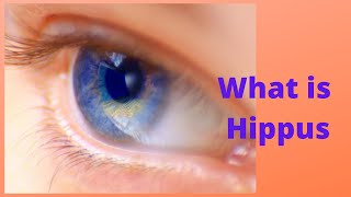 What is Hippus [upl. by Madalena490]