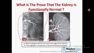 Hepatorenal Syndrome English Language  Dr Gawad [upl. by Manuela]