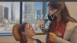 DERMA V LASER TREATMENT FOR ROSACEA  METROPOLIS DERMATOLOGY [upl. by Yrahk]