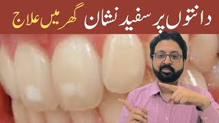 How to Remove White Spots on Teeth Home Remedies [upl. by Janicki479]