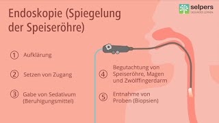 Speiseröhrenspiegelung Magenspiegelung  so läuft die Untersuchung ab Arzt informiert [upl. by Anirac207]