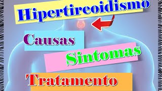 🔴Hipertireoidismo  Causas Sintomas e Tratamento [upl. by Notned]