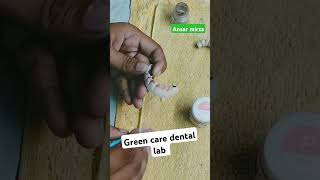 Applying the gingiva tissuedental ringtone songdentalgreens [upl. by Naivad]