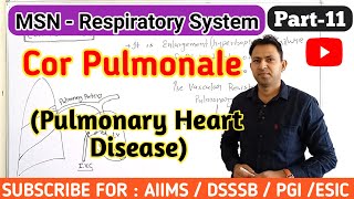 Cor pulmonale  pulmonary Heart disease  causes symptoms treatment  respiratory msn part11 [upl. by Tebor123]