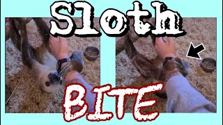 Sloth Attack Bite Video Footage [upl. by Am]