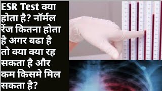 ESR Test kya hota hai konsa test karvaye ESR or CRP Erythrocytes Sedmention Rate test in hindi [upl. by Evelunn]