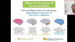 What are the types of cerebral palsy Spastic athetoid dyskinetic ataxic mixed [upl. by Hardner863]