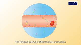 Animation E1 12 How does a dialysis machine work [upl. by Verlee]