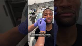 METICULOUS MASCULINIZATION  FACIAL SCULPTING [upl. by Eikram]