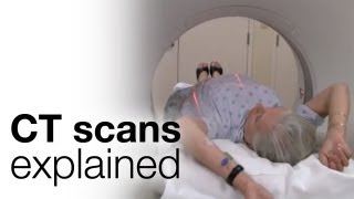 How to prepare for a CT scan [upl. by Harland]