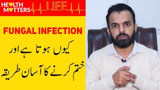 Fungal Infection Treatment  Fungal Infection of Skin In UrduHindi  Fungus Ka Ilaj [upl. by Eisset]