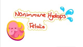 Hydrops Fetalis  causes types management complications [upl. by Alorac317]