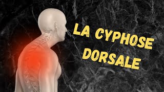 Cyphose Dorsale [upl. by Irrem]