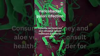 Helicobacter Pylori Infection Of the Stomach [upl. by Luke100]