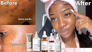 Glycolic Acid Toners SHOCKING Benefits for Your Face shorts [upl. by Amelita]