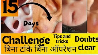 earlobe repairing15dayschallenge बिनाटांकेकेबिनाऑपरेशनdoubts clear vaishnavimakeoverandboutiquet [upl. by Dwaine766]