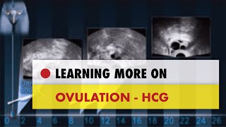 ✅ Ovulation  HCG [upl. by Map491]