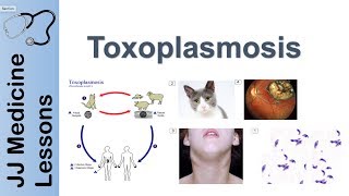 Toxoplasmosis  Acquired vs Congenital  Signs Symptoms Diagnosis and Treatment [upl. by Suolevram]