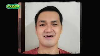 Polident Denture Adhesive TVC 2021 30s Philippines Without Subtitles [upl. by Dodge591]