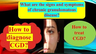 Chronic Granulomatous disease  Autoimmune disease [upl. by Key]